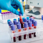 Gloved hand handling blood samples in a laboratory