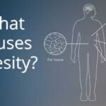 Obesity: Causes, Health Conditions, and Treatment | Mass