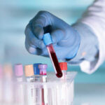 FDA Signals Hope In Brutal Child Cancer Gloved hand holding a blood sample test tube.