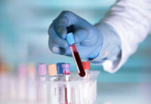 FDA Signals Hope In Brutal Child Cancer Gloved hand holding a blood sample test tube.