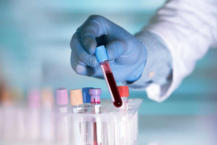 441264445 Gloved hand holding a blood sample test tube.