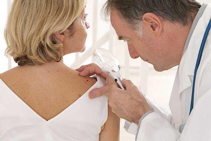 Doctor examining a patients skin with a magnifying glass